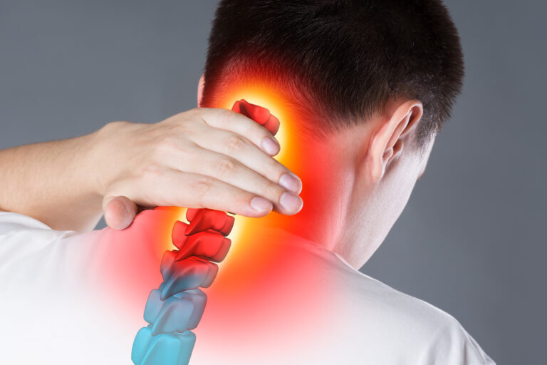 How to cure Cervical Spondylosis | Causes and Symptoms